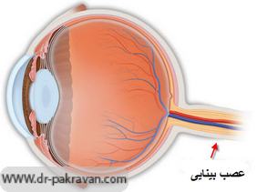 ارتباط عصب بینایی با کره چشم